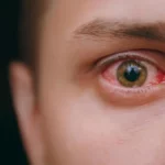 eye and kidney