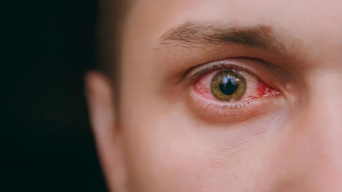eye and kidney