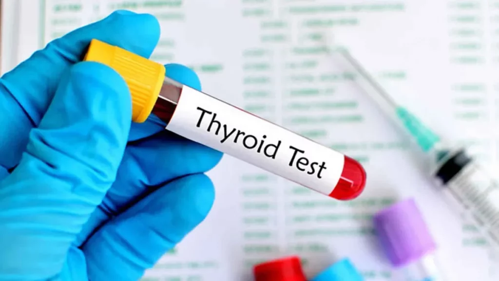 thyroid testing
