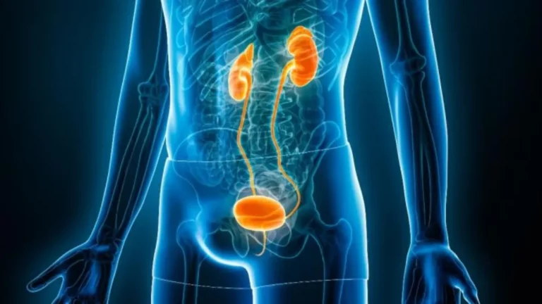 bladder cancer in India treatment approach
