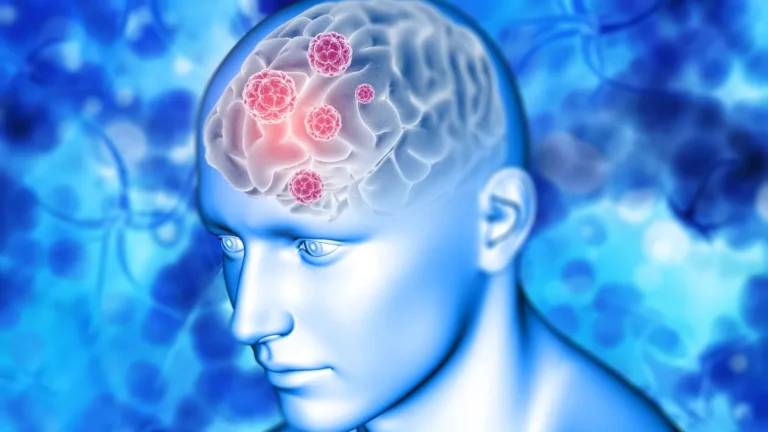 early signs of brain tumour in adults